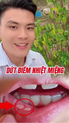 xử lý dứt điểm bệnh nhiệt miệng chỉ bằng phương pháp này  🌿🌿🌱🌱#songkhoe247♥️ #songkhoe247♥️💪💪💪 #songkhoe247 #suckhoe #suckhoesacdep #songkhoe247♥️💪💪 