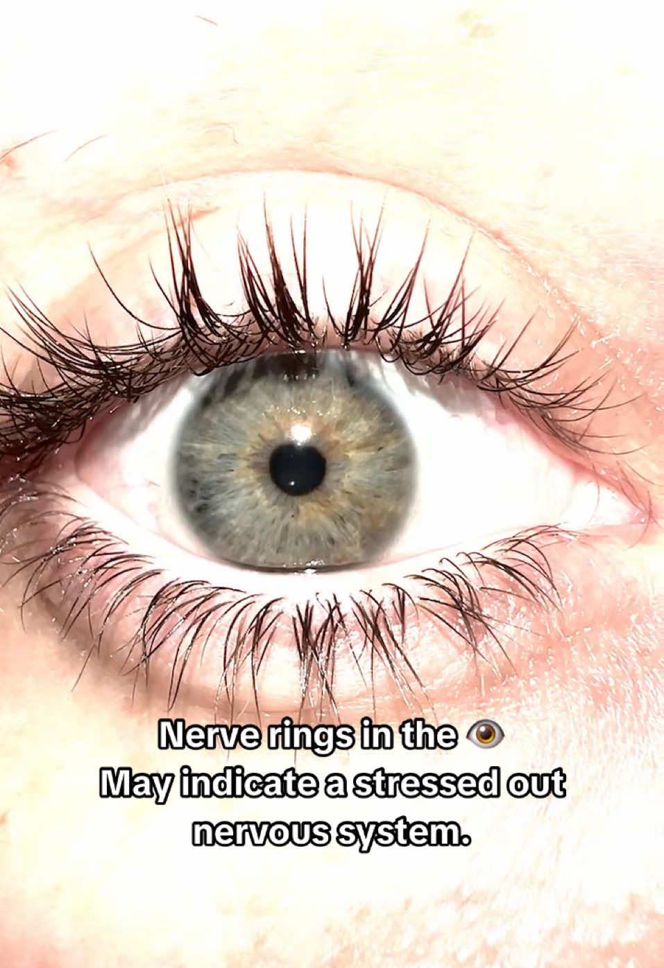 “Stress rings” Also called “cramp contraction”, or nerve rings, these rings can indicate tension in the body's muscles.  It also can reveal insights about our health, These circular patterns may be influenced by genetics, aging, health. 👁️✨ #EyeHealth #IrisPatterns #Wellness #eyes #closeup 