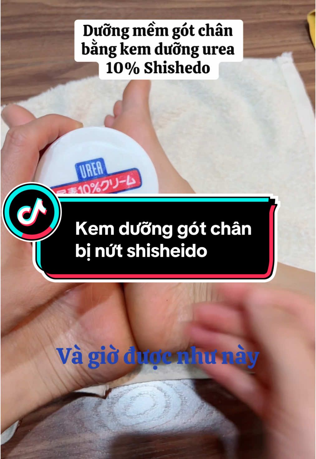 Kem dưỡng cho gót chân bị nứt nẻ, khô ráp đây nhé. 🌸🌸🌸Kem nẻ chân tay Shiseido Urea Cream Nhật Bản với thành phần chứa 10% Urea giúp loại bỏ chân tay nứt nẻ, da thô ráp, trả lại cho bạn làn da mềm mại, ẩm mịn 🌸Làm sạch vùng da,, sau đó cho một lượng kem vừa đủ ra lòng bàn tay, mát xa nhẹ nhàng để kem có thể thẩm thấu đều. Đối với những bạn đang gặp phải vấn đề gót chân, khuỷu tay bị khô, nứt nẻ trầm trọng, thì các bạn nên rửa tay bằng nước ấm (hoặc nước muối), dùng khăn mềm lau khô tay sau đó mới dùng kem. #chamsocda #nutgotchan #kemtrinutgotchan #kemnutgot #kemduonggotchan