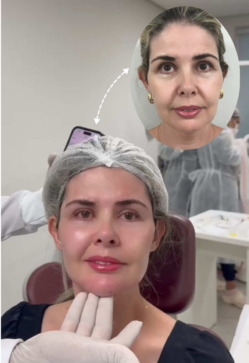 Hermoso, Armonización Orofacial.  #fullface #botox #armonizacionfacial 