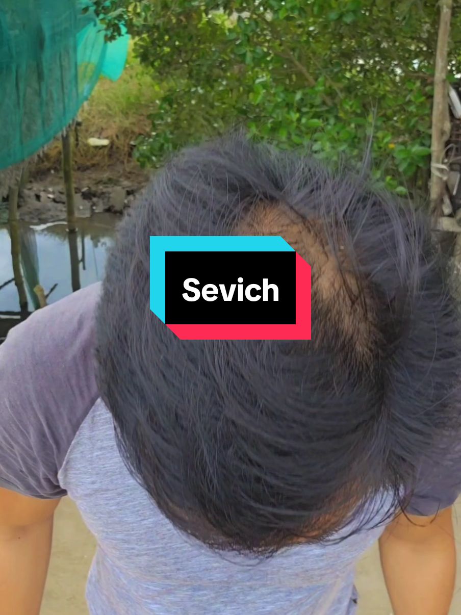 Sevich Hair Shadow Powder para sa manipis ang buhok at napapanot na #sevichhairpowder #hairshadowpowder #bald #hairstyle 