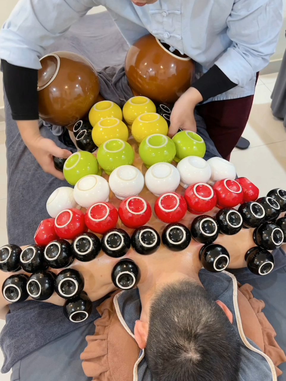 [ASMR] It feels so relaxing #asmr #massage #trilieuhaiphong #cuppingtherapy #Giachoi #xuhuong 