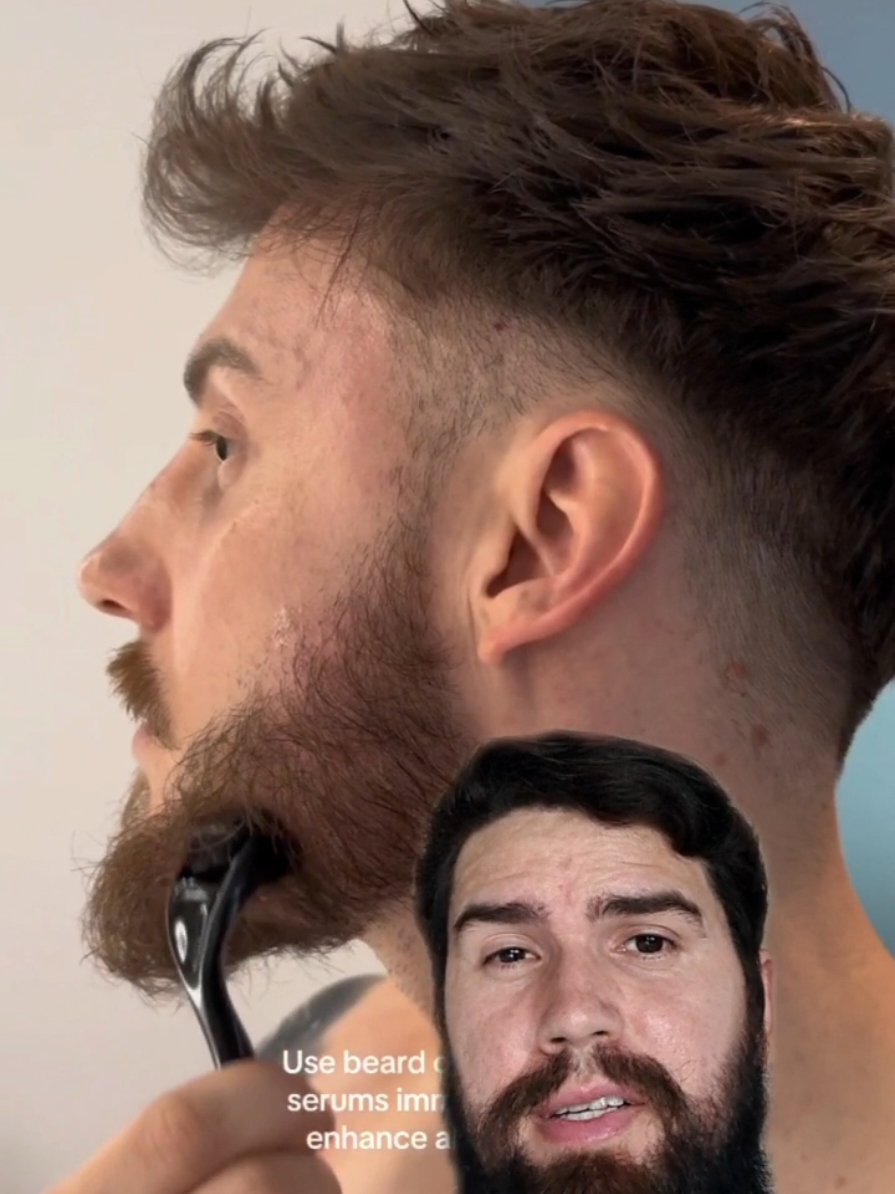 Dermaroller para barba.🧔🏻‍♂️🙌🏻 #dermaroller #microagulhamento #barba #crescimentocapilar 