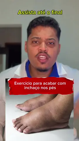 Como reduzir o inchaço nos pés #exercicioemcasa #pes #inchado #dornospes #pesinchados 