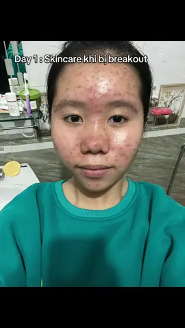 Có nên bôi nghệ tươi không mọi người ? #skincare #trimun #xh #tet #skincareroutine 