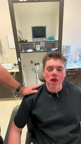 Wisdom teeth part 2 #fyp #wisdomteeth #anesthesia #wisdomteethremoval #funnyvideo 
