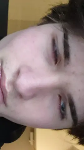 #eyes #eyesarea #blueeyes #huntereyes #psl #appeal #sub5 #chadlite #htn #mtn #ltn #brutal #mog #gameofbones 