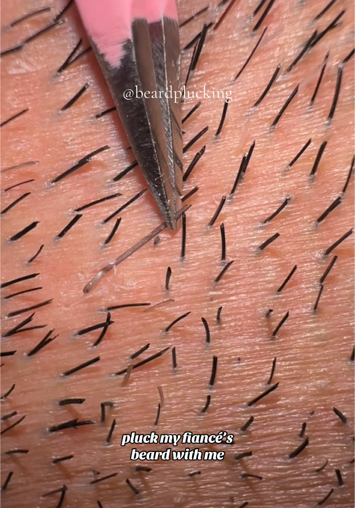 pluck my fiancé’s beard with me 🤭 tweezers linked in my showcase!