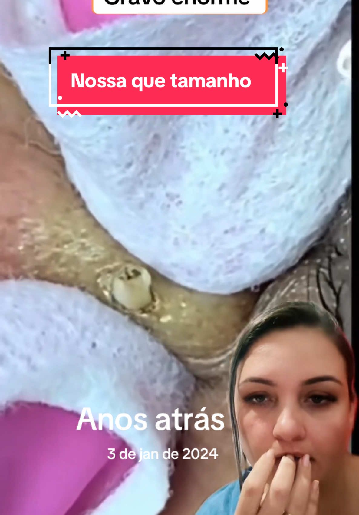 #anosatrás #cravos #satisfatório #terapia #limpezasatisfatoria #reagindo muitooo grande 