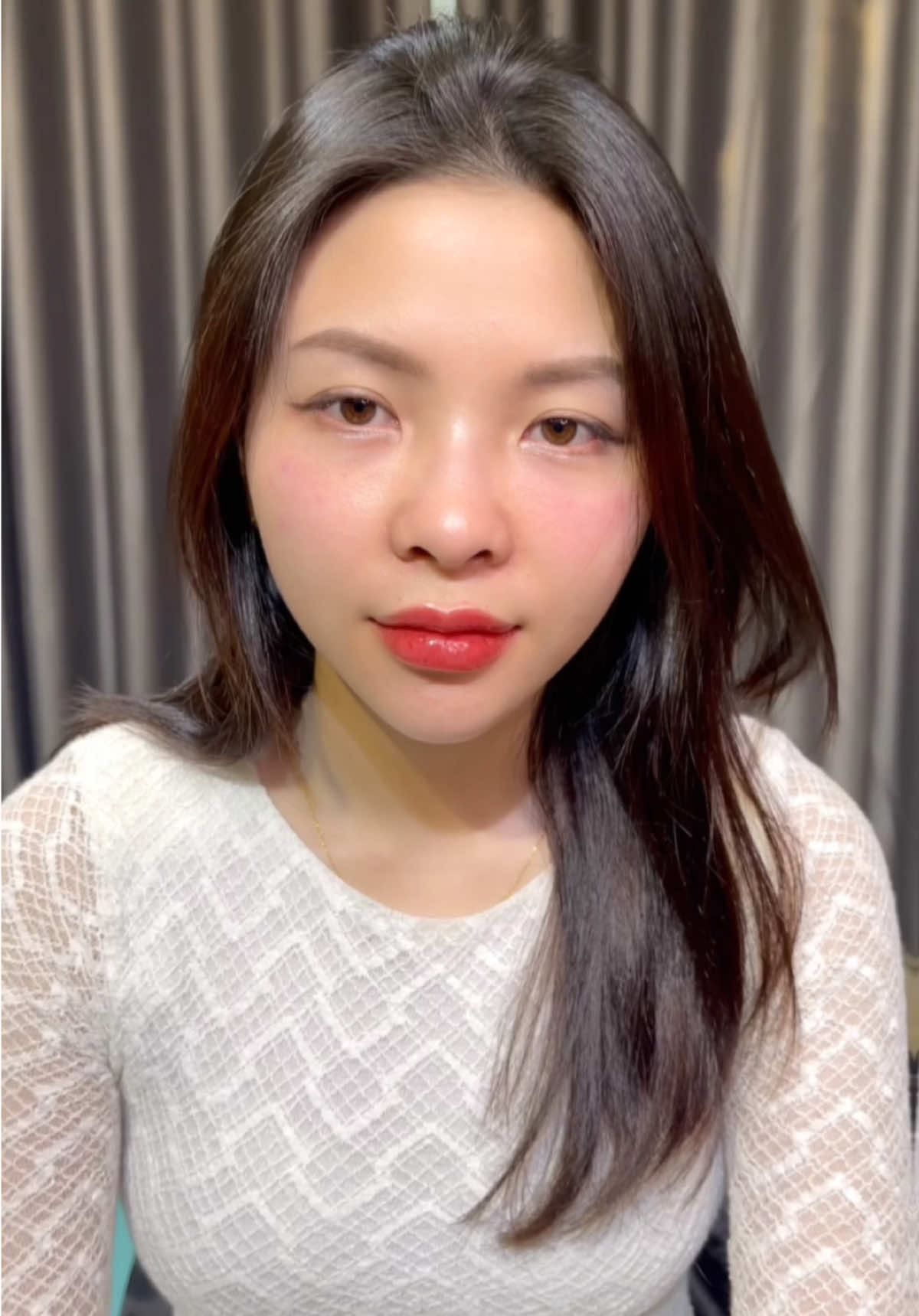 #Dahliabeauty #Hienanfiller #fillerbotox #babyface 