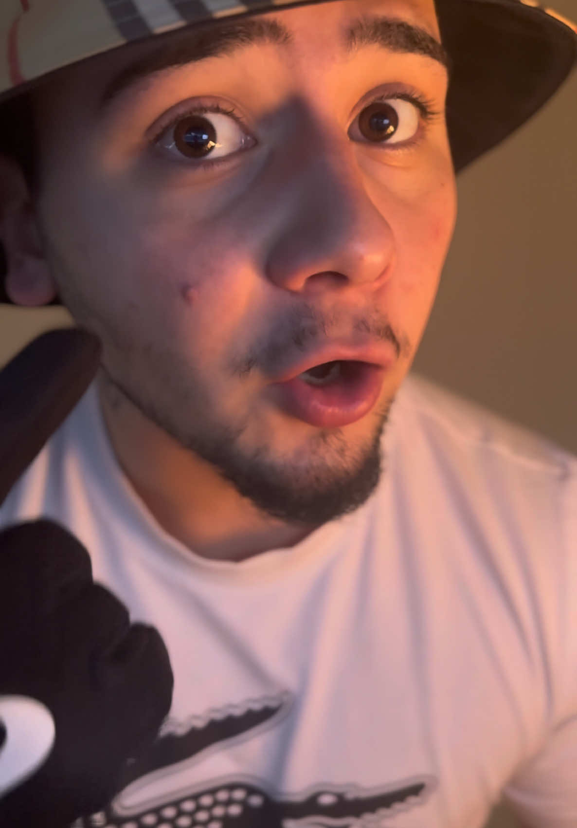 Aula Cancelada Pamodi Berbulha Di Me*** Na Nha Rosto… Rosto Mo Catxor, Nhos Tá Goza Cumi Só Podi.😕🥸🦷 #luvadinike 