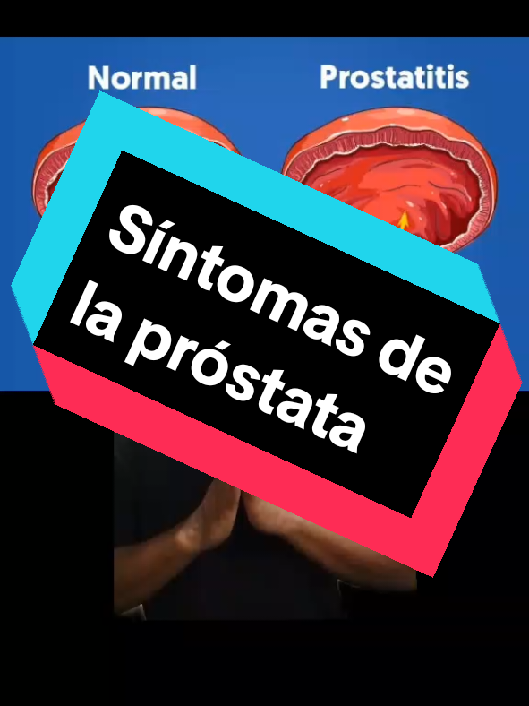 contáctanos para más información en mi perfil. #próstata #hombre #masculinidad #salud #tratamiento #Usa #california #viral_video #typ 
