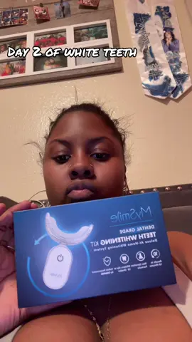I’m always looking crazy mb yall 🤦🏾‍♀️ #teethcare #teethcleaning #uvteethwhitening #mysmile #braces #teethtok #spotlightfinds #newyear #fy 
