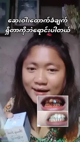 #viewတက်စမ်းကွာ👊 #foryoupage #viewmillion #သွားနှင့်ပတ်သတ်သောပြသနာများကိုကူညီဖြေရှင်းပေးပါတယ် #beautysmileသွားဖြူဆေး #မဖြူရင်ငွေပြန်အမ်းမယ်🔥 