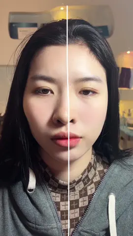 Tết tới nơi rồi ce ơi . Combo thái dương má hớp nhà miumiuspa như thay đầu 🫣#miumiuspa #miumiu #moi 