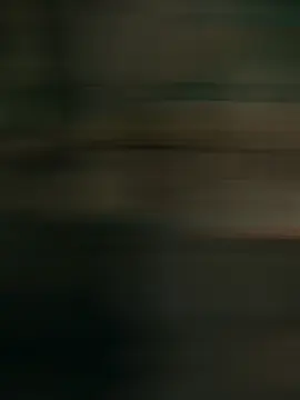 friend with same mental disoder is blessing #CapCut #honeybunny #fyp #trending #fypシ゚viral #art_ey #dance @sushila malla 