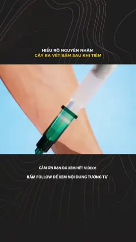 HIỂU RÕ NGUYÊN NHÂN GÂY RA VẾT BẦM SAU KHI TIÊM #LearnOnTikTok #xuhuongtiktok #khampha #khoahoc 