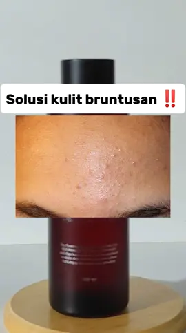 best produk eksfoliasi dari avoskin ❤️ #refiningtoner #skincarereview #bruntusan @avoskinbeauty 