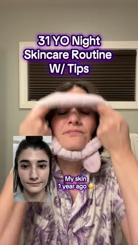 Skincare can be intimidating, but the best thing I did for myself last year was invest in me and take the time to learn and build a skincare routine I would stick with.  #skincareroutine #skincarevideo #skincareinyour30s #skincaretips #skincareproduct #skincareforbeginners #beginnerskincare #SkinCare101 #skincarehowto #easyskincaretips #antiagingskincare #antiagingtips #buildaskincareroutine #nighttimeskincare #nighttimeskincareroutine 
