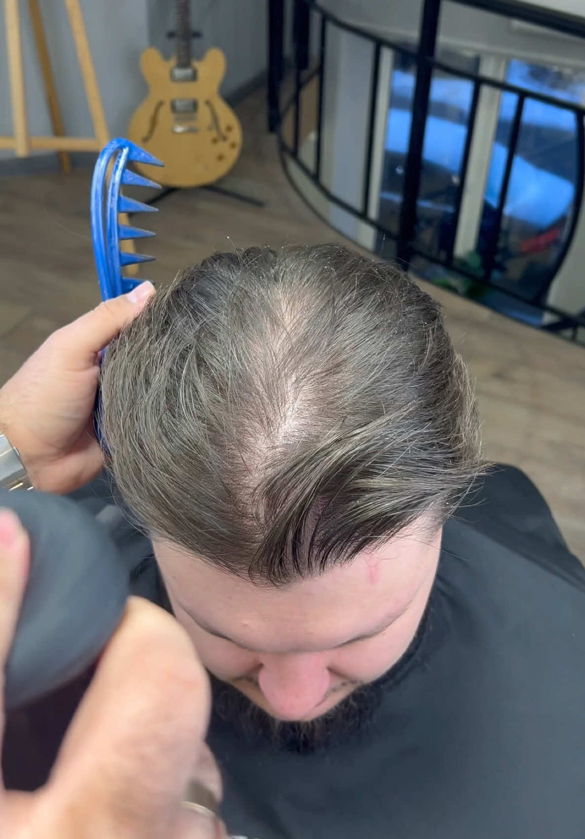 Most natural Hair fibers by THICK FIBER Available at @amazon  #hairfibers #hairthickener #hairbuildingfibers #hairfibres #hairlossconcealer #haircare