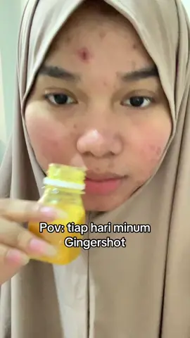Ga di endorse nyet.