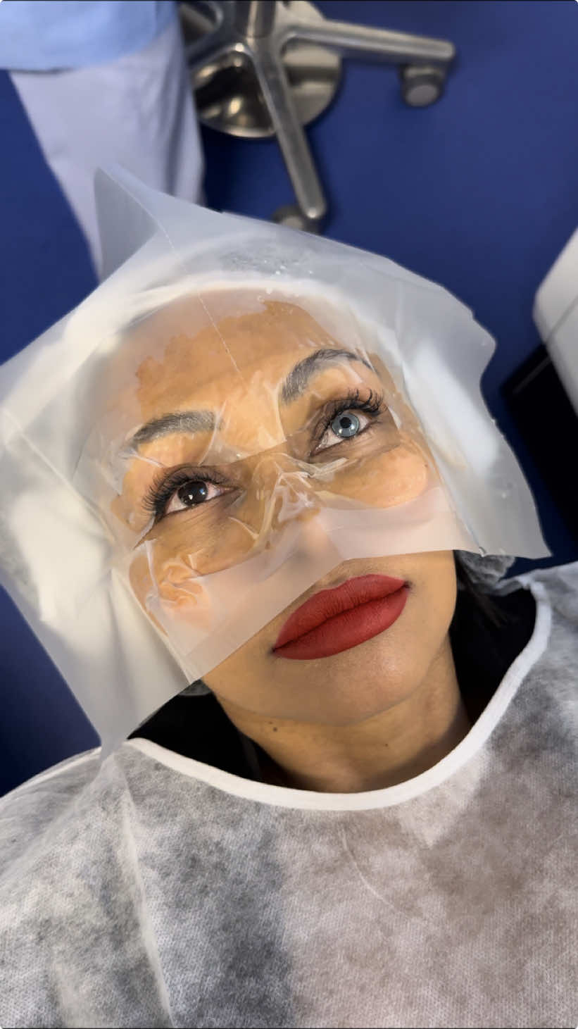 Eye color change using the FLAAK Pro technique, the most advanced and natural keratopigmentation ☝🏼 On the advice of FLAAK (by New Color), she chose the Warergreen color at the New Vision clinic in Nice 🇫🇷 You dream about changing the color of your eyes ? Send us a PM 💌 #newcolor #flaak #keratopigmentation #visumax #visumax800 #eye #eyecolorchange  ##קרטופיגמנטציה #ceratopigmentação #تصبغ القرنية #cheratopigmentazione