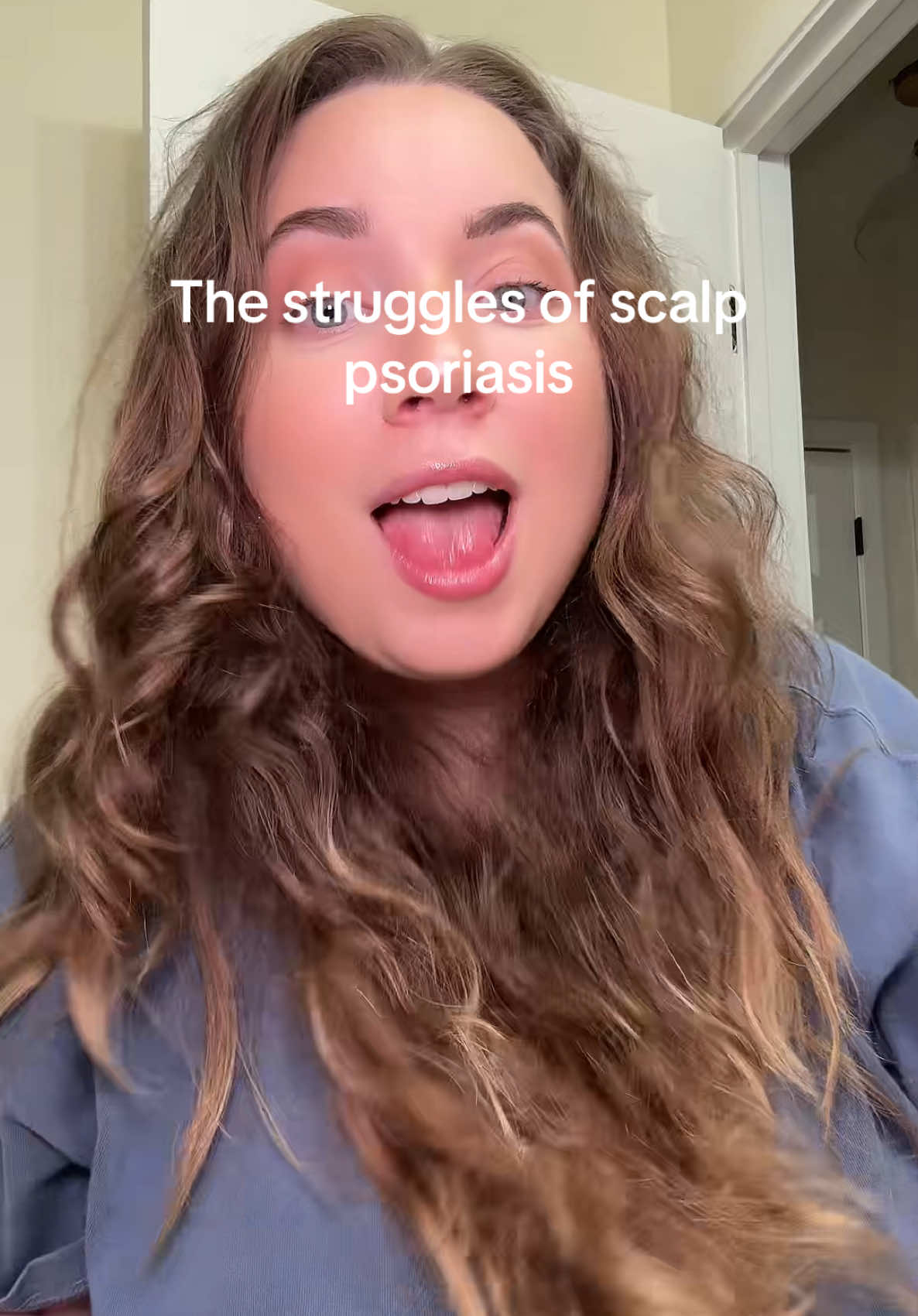 I have struggled with scalp psoriasis for over 10 years. Nothing ever works🫠 #fyp #scalppsoriasis #scalphealth 
