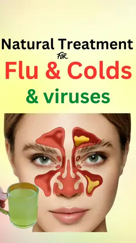 Natural treatment for viruses, flu and colds #flu #colds #fluandcolds #congestion #lemon #lemonjuice #infections #viruses #cloves #bacteria #asthma #bronchitis #coughs #honey #health 