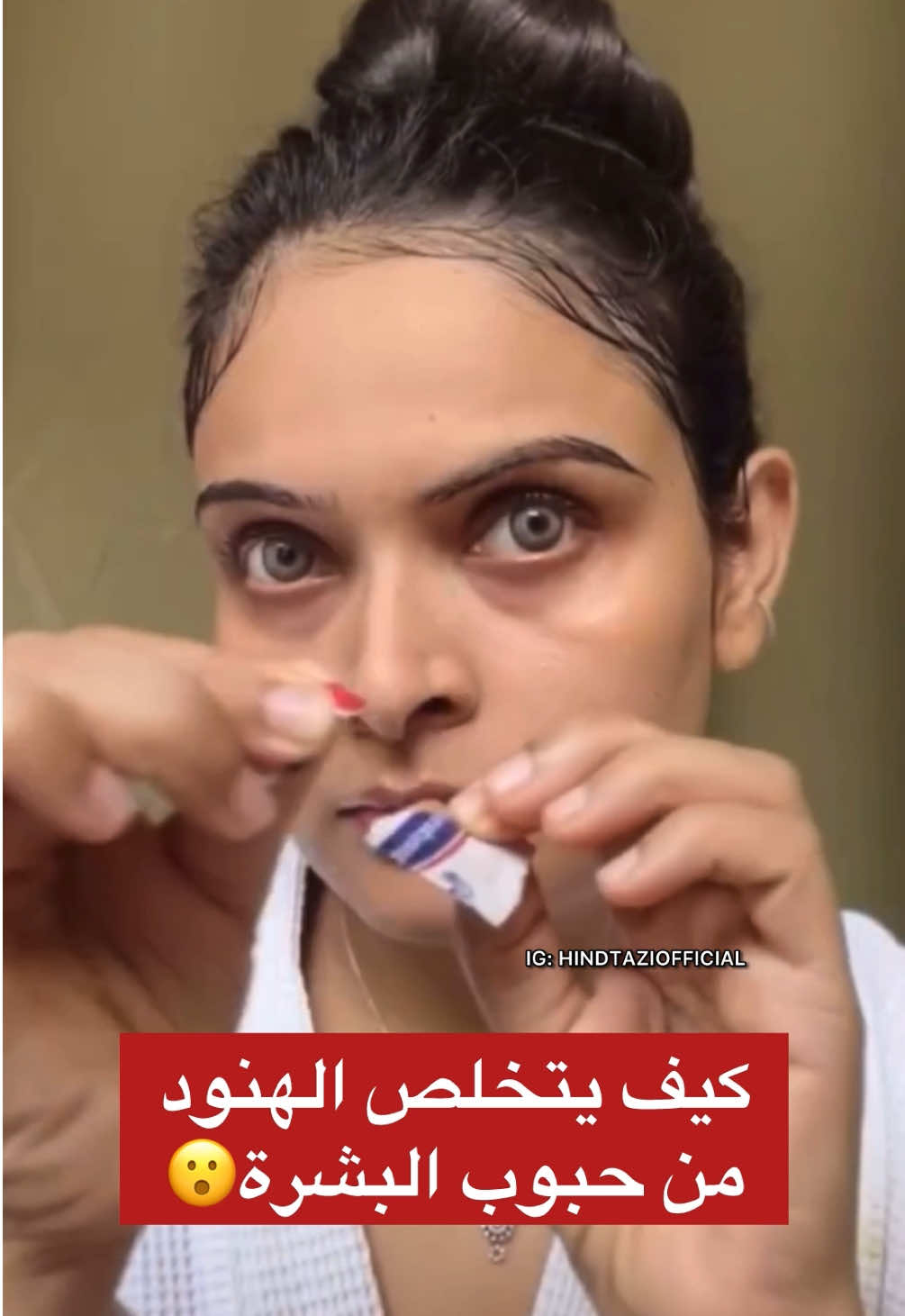 خليط من الشبة مع خل التفاح مخفف بالماء. حطيه على وجهك قبل ما تنامي وخليه طول الليل. فالصباح غادي تلاحظي الفرق، حيث هاد المزيج كيعاون على تهدئة البشرة وتنظيف المسام بشكل فعال. بغيتو تستافدو من نصائح كثيرة 🤍 📲 تابعوني، حسابي غادي يفيدكم 