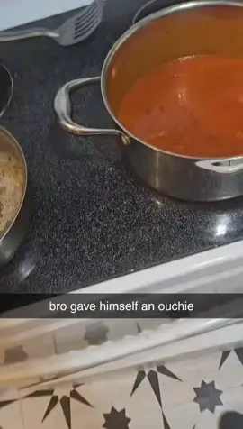 Bro gave himself an ouchie#fyp#funny#meme#gabermeme#grilledcheese 