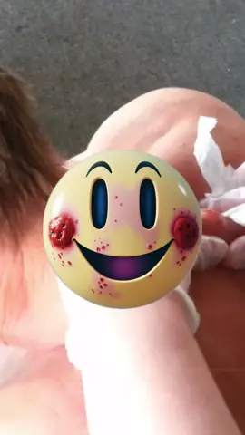 #satisfyingvideo #skinecare #4you #squeeze #tiktokviral #viral_video #cystpopping #fyp #pimpleglow #explore #grow #goviral #tik_tok #creative #tiktoker #4upage #stitch 