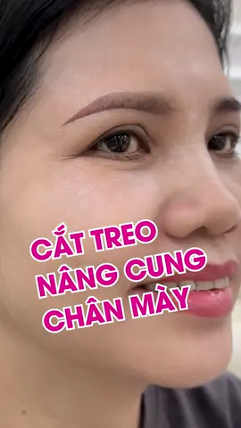 Phốt Mailisa Cắt Treo Nâng Cung Chân Mày giấu chỉ độc quyền với giá 6.000.000 đồng có đẹp tự nhiên không? Trăm nghe không bằng mắt thấy, mời cả nhà cùng theo dõi video để lắng nghe chia sẻ của chị khách hàng sau khi thực hiện dịch vụ Nâng Cung Chân Mày Trực tiếp Perfect Form tại Mailisa nhé! #photmailisa #mailisagroup #tmvmailisa #mailisagroup #mailisagroup #lamdepkhongkho #xuhuong #xuhuonglamdep #pttm #phauthuatthammy #cattreolongmay #nangcungchanmaygiauchi #nangcungchanmay #nangcungchanmaydep #cattreo #cattreolongmay #cattreocungchanmay #lamdepmailisa