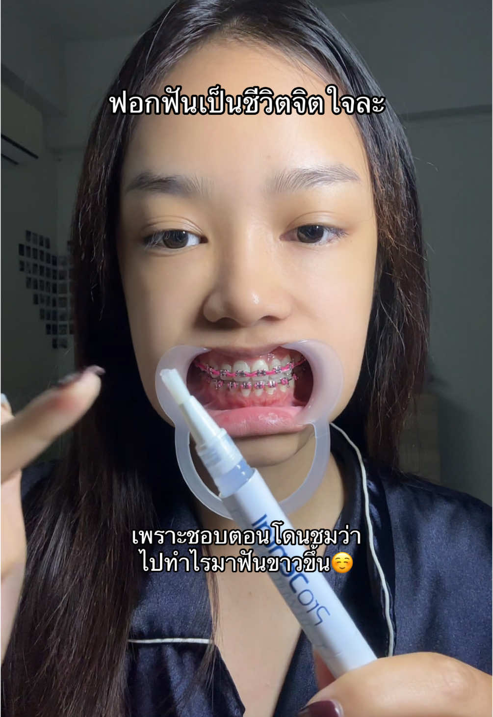 เขินง่ะ😆🤟🏻#prodental #เจลฟอกฟันขาว #เจลฟอกฟันขาวแทนธันเดอร์ 