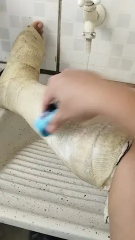 gesso ortopédico #fe #cura #tik #tok #viral #tiktokviral #tiktokuni #featureme #euvouvencer #reflexaododia #