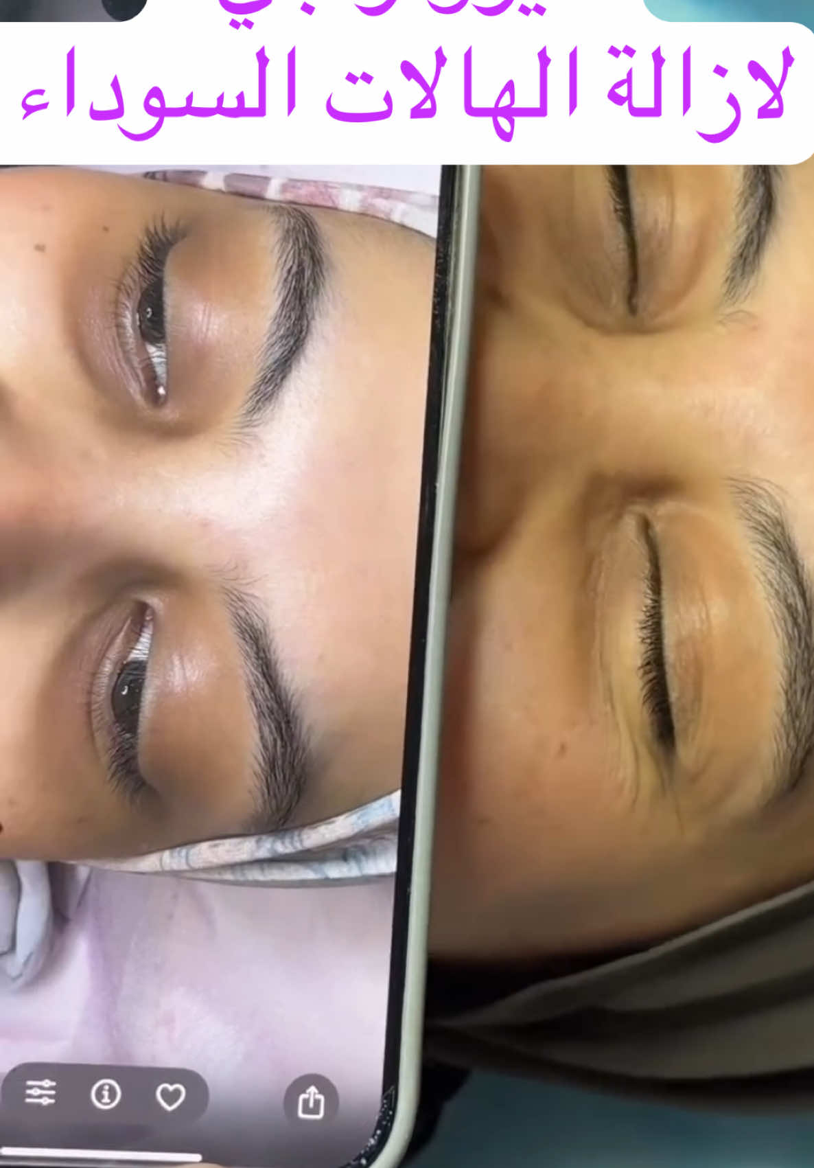 #الجالية_المغربية_في_كل_مكان💚 #bernoussi #fouryoupage_tiktok_ #شعب_الصيني_ماله_حل😂😂 #البرنوصي_الازهر #ainsbaa_derbsultan_casablanca_maroc❤💚🇲🇦 #تجميل_جمال_البشره_علاجات_للبشره #soinvisage #الهالات_السوداء_تحت_العين ##centerprimabeauty @Jijii  @Centre prima 