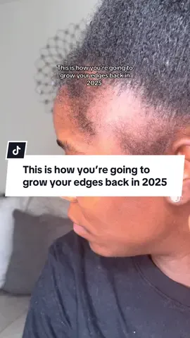 Let 2025 be the year you reclaim your edges and your confidence. #bhringrajhairoil #naturalhair #ayurveda #hairlossremedies #ayurvedichaircare #hairgrowthoil #hairoilling #tractionalopecia 