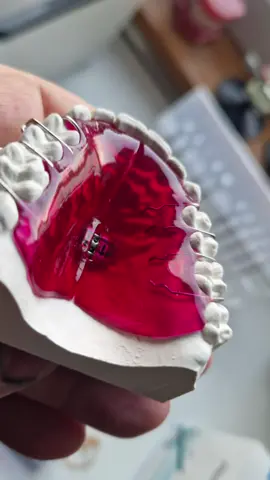 Expander is a cheat code #mewingshop #mogged #chicolachowski #jordanbarrett #mewing #chicolachowski #jordanbarrett #looksmax #looks #mogg #mogging #looksmatter 