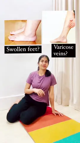 swollen feet/varicose veins  ##swollen #swollenankle #sprainedankle #brokenankle #anklesprain #anklebrace #cast #crutches #acewrap #crutchlife #crutcheslife #aircast #boot #varicoseveins #crutchesagain #crutchesfordays #acebandage #crutch #swelling #swollenfeet #pain #health #healing #ankle #podiatry #pregnancy #chronicillness #Fitness #diabetes #surgery #lymphedema 