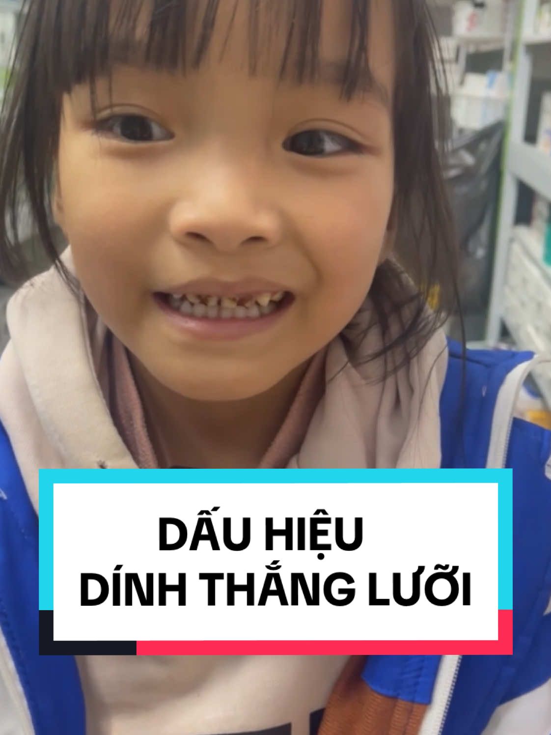 Mình đã khuyên gđ đi khám sớm để có can thiệp kịp thời cho con ♥️ #suckhoe #duocsi #dinhthangluoi #noingong 