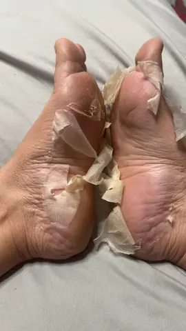 #plantifique #footpeelmask #plantifiquefootpeelmask #mascarillaparapies #tiktokshop #videoviral @Plantifique 