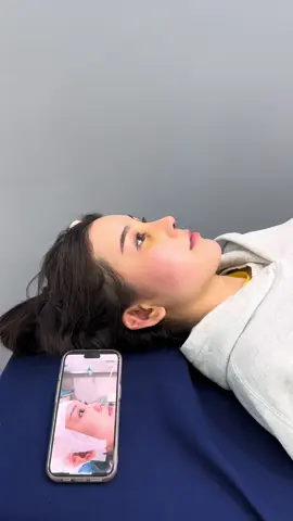 Mũi Cấu Trúc Thượng Hải 3 Ngày Tái Khám #mũicautruc #nângmui #sửamuihong #muisunsuon 