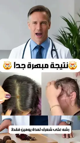رشيه على شعرك لمدة يومين فقط ستبهرك النتيجة ✅️ #تطويل_الشعر #تنعيم_الشعر #تساقط_الشعر