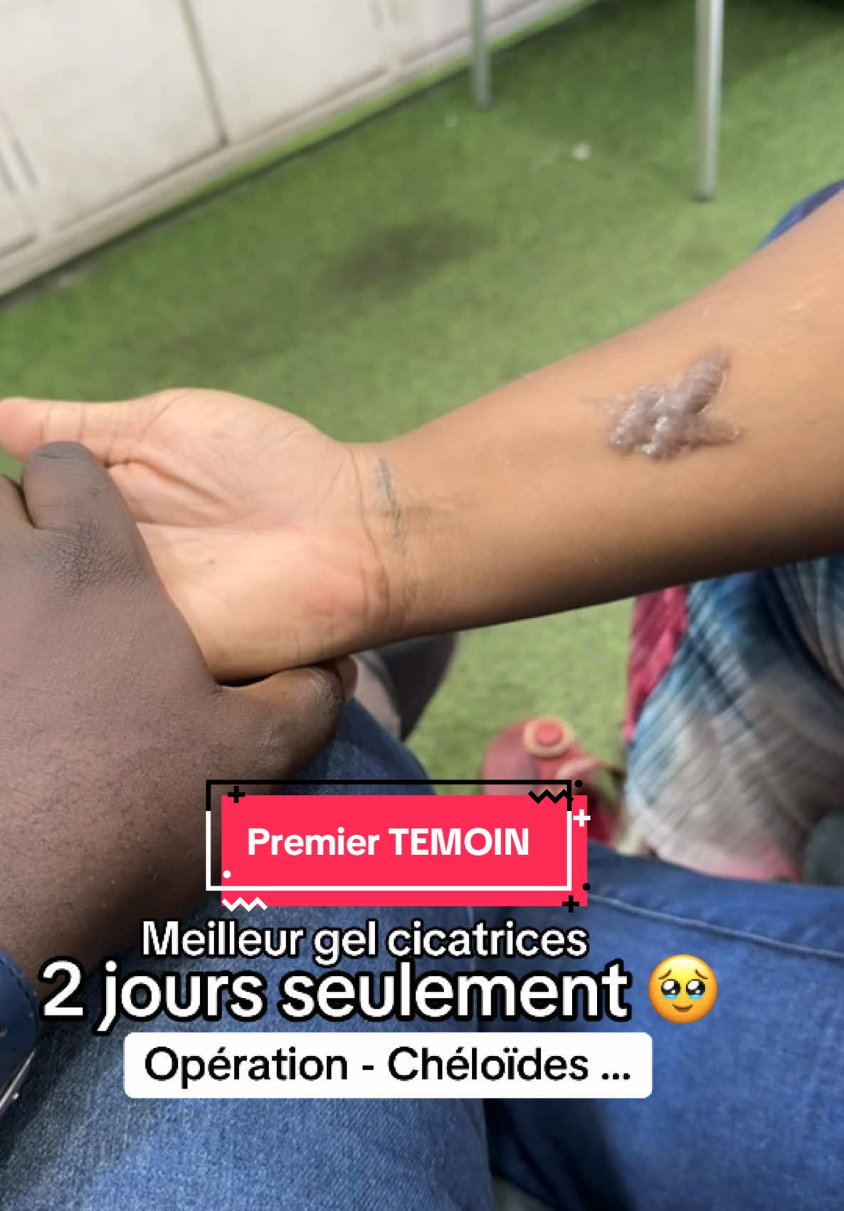 🥳🥳🥳🥳🥳🥳🥳🥳🥳🥳🥳 On gère ohhhhhhh  —— #SoinsVisageEtCorps #cicatrices #RéparationCutanée #scar #scarstoyourbeautiul  #ByeByeVergetures #PeauNeuve #SoinRévolutionnaire #Afrique #TikTokAfrique🇹🇬🇨🇩🇨🇮🇧🇯🇬🇦🇨🇲🇬🇦 #Abidjan225🇨🇮 #Daloa #Dakar #Senegalaise_Tik_Tok #Siguiri #TikTokGuinee224🇬🇳 #Congolaise🇨🇩 #Gambian_Tiktok🇬🇲 #BeninTiktok🇧🇯 #TogoTiktok228🇹🇬 #CotedIvoire🇨🇮 #ModeAfrique #BeautéAfricaine #InspirationAfrique #SoinPeau #vergetures 