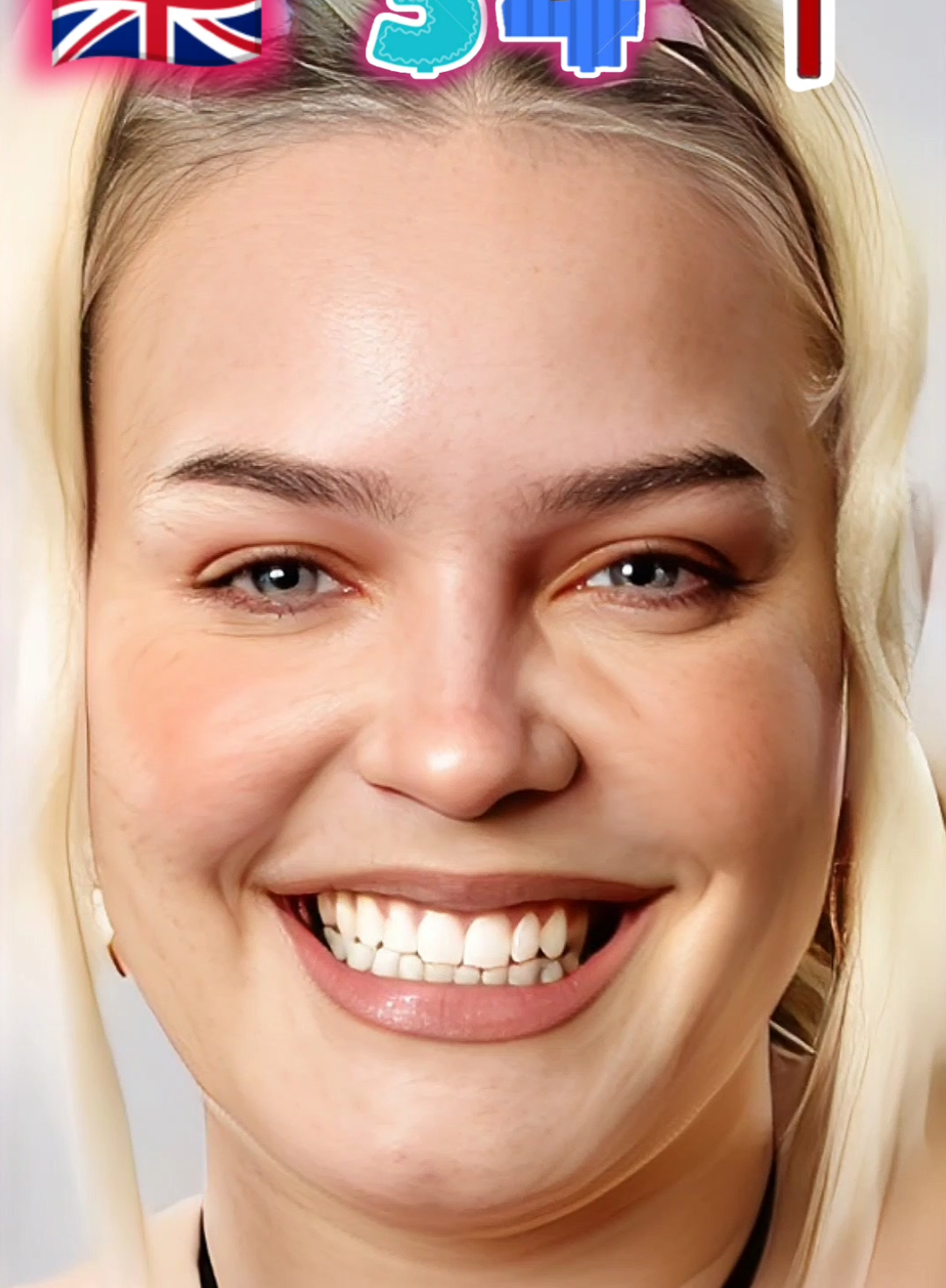 Anne-Marie Before and Now #annemarie #singer #uk #stiifgm 