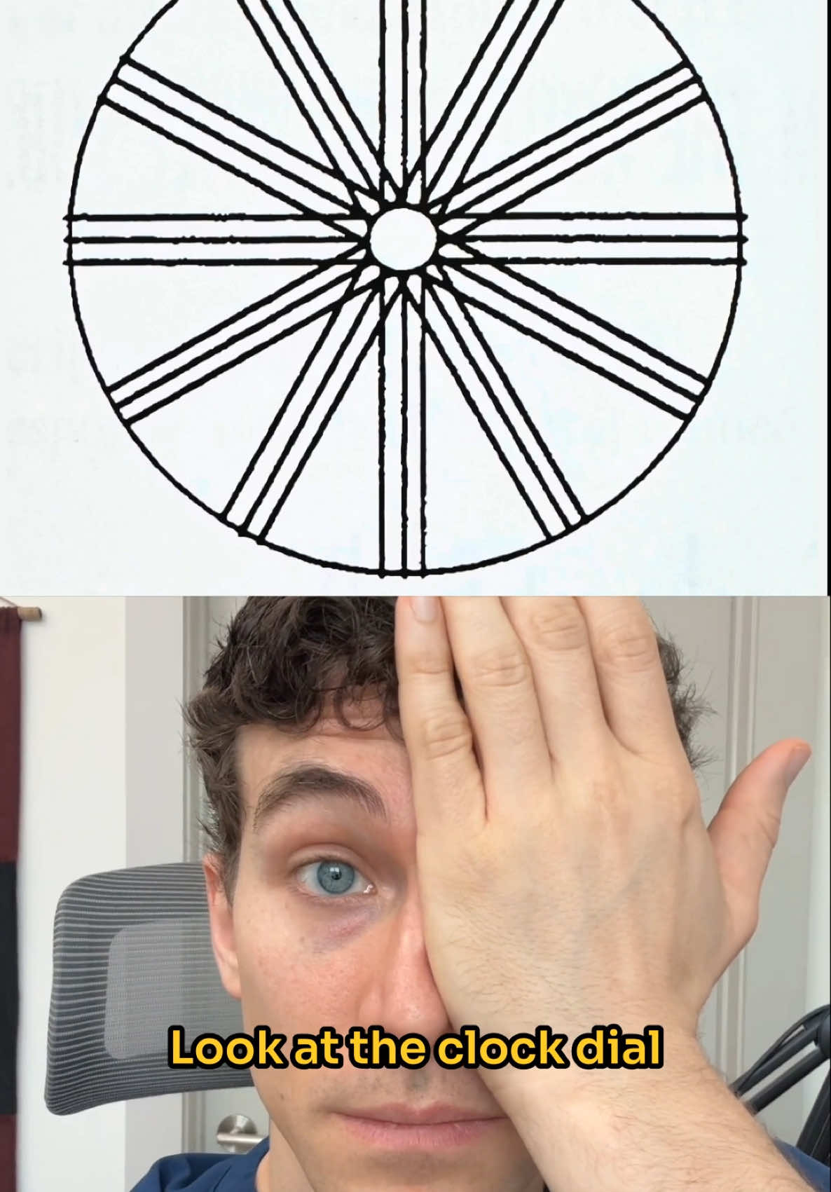 Astigmatism test at home 🏠 👀  Astigmatism can affect how you see the world by causing blurred or distorted vision, and it often goes unnoticed. In this video, we’ll show you how to use a simple clock dial test at home to check for signs of astigmatism. This quick and easy test involves looking at a pattern of radiating lines to identify if some appear darker or clearer than others—a potential indicator of astigmatism. While the clock dial test is a helpful tool, it’s not a substitute for a comprehensive eye exam. If you suspect you have astigmatism, be sure to schedule a visit with your eye doctor for an accurate diagnosis and proper treatment options. 👉 Try the test and let us know your results in the comments! Don’t forget to like and follow for more eye health tips and tricks!  #Astigmatism #VisionTest #HomeVisionTest MEDICAL ADVICE DISCLAIMER: All content in this video and description including infor­ma­tion, opinions, con­tent, ref­er­ences, and links is for infor­ma­tional pur­poses only. The Author does not pro­vide any med­ical advice on the Site. Access­ing, viewing, read­ing, or oth­er­wise using this content does NOT cre­ate a physician-patient rela­tion­ship between you and its author. Pro­vid­ing per­sonal or med­ical infor­ma­tion to the Principal author does not cre­ate a physician-patient rela­tion­ship between you and the Principal author or authors. Noth­ing con­tained in this video or its description is intended to estab­lish a physician-patient rela­tion­ship, to replace the ser­vices of a trained physi­cian or health care pro­fes­sional, or oth­er­wise to be a sub­sti­tute for pro­fes­sional med­ical advice, diag­no­sis, or treatment. You should con­sult a licensed physi­cian or appropriately-credentialed health care worker in your com­mu­nity in all mat­ters relat­ing to your health.