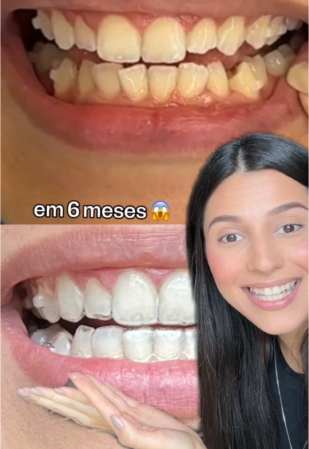 Aproveite os benefícios especiais de Summer Sale para iniciar seu tratamento. Agende agora sua avaliação! 🧡