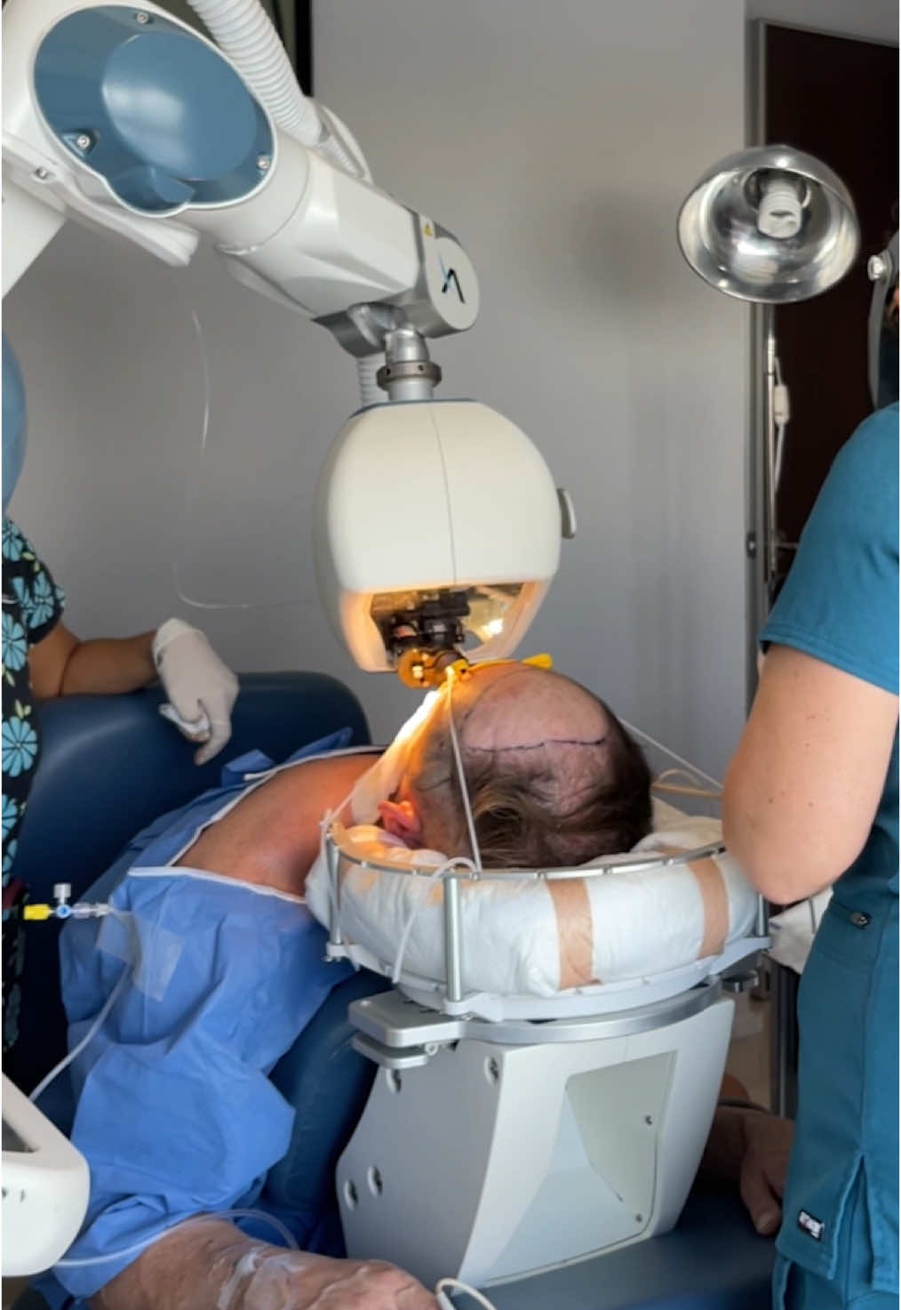 ARTAS Robotic Hair Transplant combines technology and precision for natural, consistent results. 💇‍♂️ AI selects the best grafts, while our team ensures every detail is perfect. Ready for a transformation? DM us today!  #hairrestoration #medicaltourism #hairtransplant #cancun #artashairrestoration #hairtransformation #newhair #newyou #newyear 