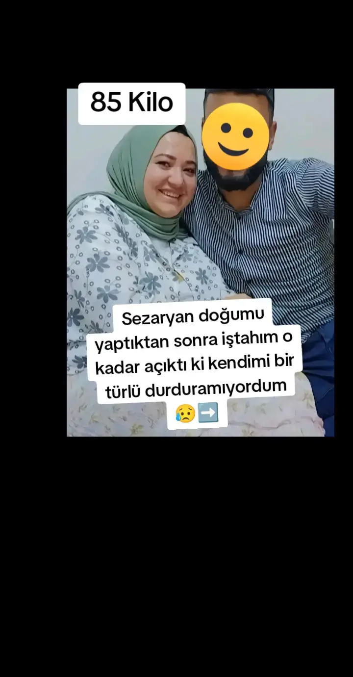 90 KİLODAN 59 Kiloya geçiş 🥳🥳💪Sezaryan doğumu yapmış olmam Kilo vermeme engel olmadı.🥳Biz Başardık 🥳🥳 #kesfetteyiz #keşfetbeniöneçıkar #kahveseverler #kilovermekisteyenler #kahve #zayıflamakisteyenler  #kiloverme #dönüşümöyküsü #sağlıklıyaşam #motivasyon #fitolmak #kiloverme #kiloverecem #kilover #kilovermekistiyorum #kilovermetaktikleri #keşfet #keşifönerisi #keşif #fyp #viral #pyf #gucci #fyppppppppppppppppppppppp #keşfetteyizzz #yurtdışındayaşam #yurtdışındakitürkler #yurtdışı #almanyadakitürkler #fransadakitürkler #live #livepool #fyp #tiktokindia  #livechalange #kiloalma #kiloalmak #kilokontrol #kiloalmakiçintavsiyeler #kiloalmanınyolları #kiloalmakistiyorum #kiloalmakistiyorumdiyenlerebirebir #kiloalmadiyeti #keşfet #keşfetbeniöneçıkar #fyp #viral #pyf #gucci #keşifönerisi #keşfet #keşfetteyiz #öneal #tiktok #beauty #yurtdışındayaşam #yurtdışındakitürkler #yurtdışı #almanya #almanyadakitürkler #almanyadakitürkler🇹🇷🇹🇷 #keşfetteyizzz #fypシ゚ #keşfet #viral #kesfetteyiz #keşfetbeniöneçıkar #kahveseverler #kahveseverler #kiloalmakistiyorum #kiloalma #sağlıklı #kiloalmakisteyenler 