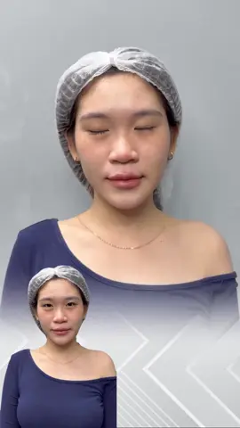 ✨Thay đổi hoàn toàn mới dịch vụ tạo hình độc quyền nhà Louis💓💓#Đào_tạo_học_viên_chuẩn_y_khoa #Tiêm_môi_đẹp #xuhuong 