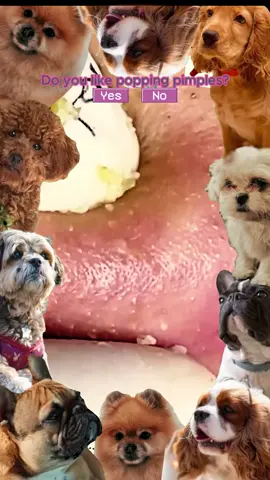 #squeezeyuk #satisfying #pimple #foryou #relax 